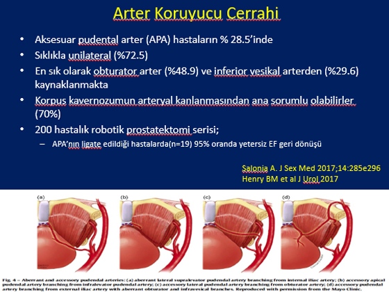 Radikal Prostatektomi Sonrası Erektil Disfonksiyon