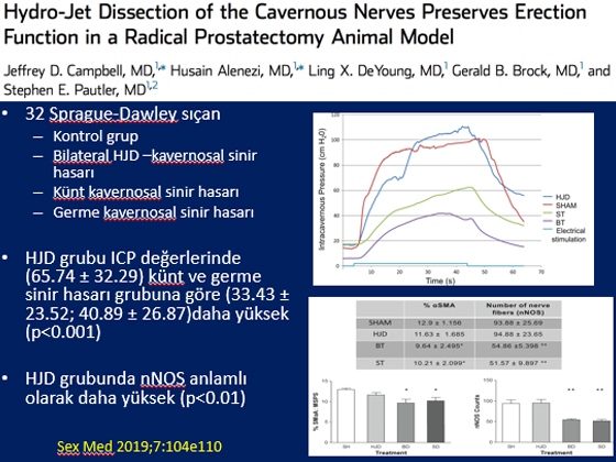 Radikal Prostatektomi Sonrası Erektil Disfonksiyon